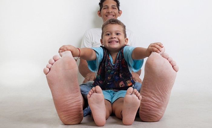 Record: l’uomo con i piedi più lunghi del mondo!